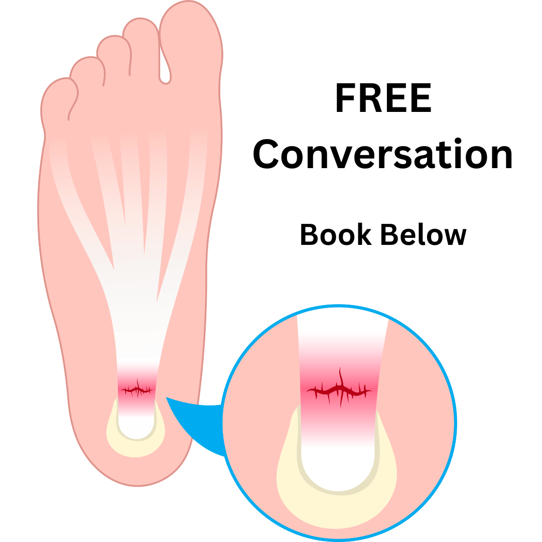 Plantar Fasciitis (1)
